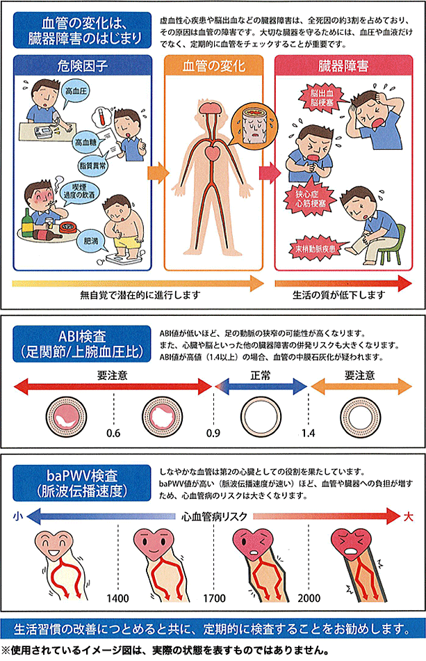 血管の変化は、臓器障害のはじまり
